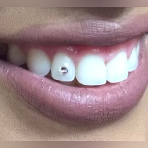 Bling Trap Beginner Tooth Bling Kit - Picture 8 of 8